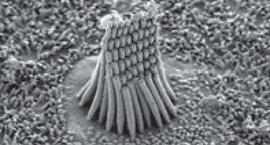 Сканирующая электронная микроскопия. Чувствительные клетки внутреннего уха - видно структуру мембран.